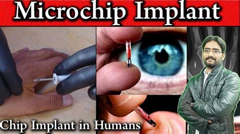 rfid chip implant texas|Microchip implant (human) .